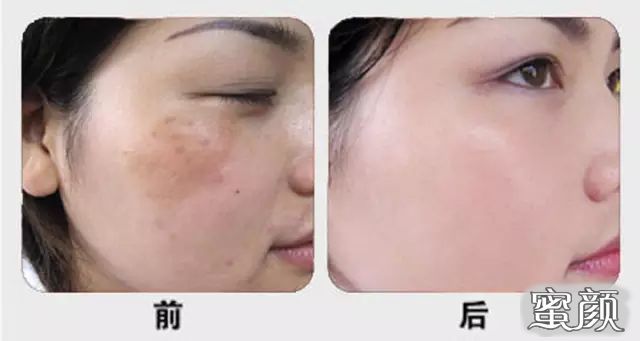 https://img.miyanlife.com/mnt/Editor/2020-12-17/5fdb2013f1e74.jpg