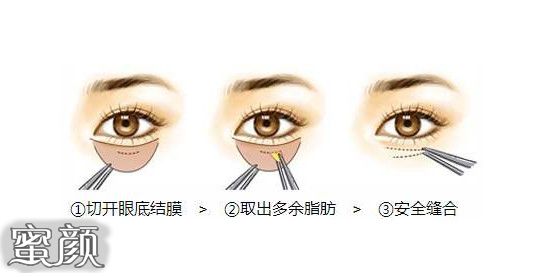 https://img.miyanlife.com/mnt/Editor/2020-12-18/5fdcb4cb8dbc4.jpg