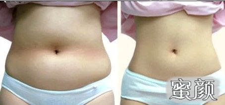 https://img.miyanlife.com/mnt/Editor/2020-12-19/5fdd37aa5abaf.jpg