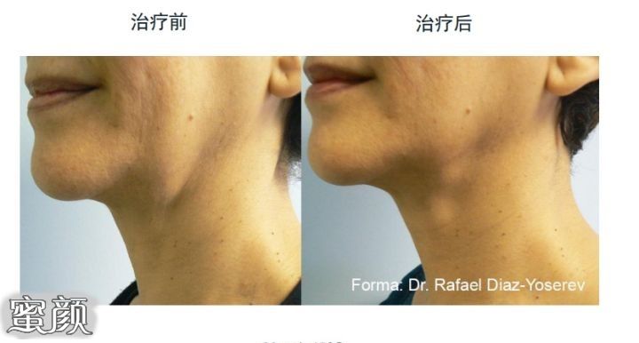 https://img.miyanlife.com/mnt/Editor/2020-12-22/5fe1a3dd48033.jpg