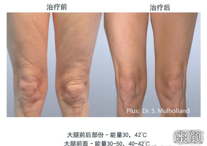 https://img.miyanlife.com/mnt/Editor/2020-12-22/5fe1a4260ad85.jpg
