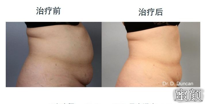 https://img.miyanlife.com/mnt/Editor/2020-12-22/5fe1a4307f174.jpg