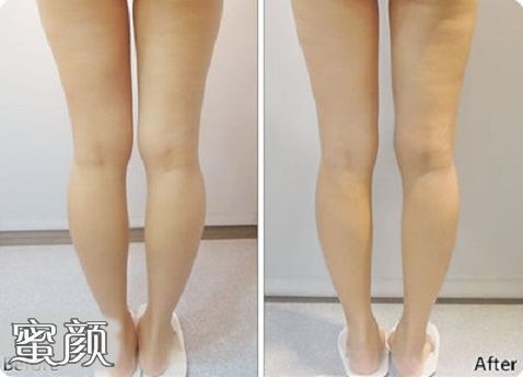 https://img.miyanlife.com/mnt/Editor/2020-12-22/5fe2064160b5c.jpg