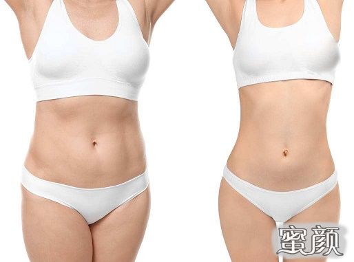 https://img.miyanlife.com/mnt/Editor/2020-12-22/5fe207704e56f.jpg