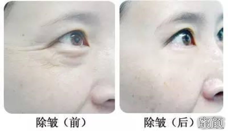 https://img.miyanlife.com/mnt/Editor/2020-12-25/5fe5a1862d4fe.jpg