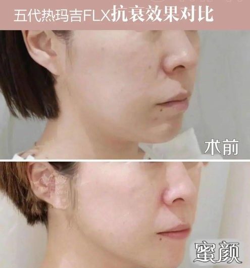 https://img.miyanlife.com/mnt/Editor/2020-12-25/5fe5d2e7f169c.jpg