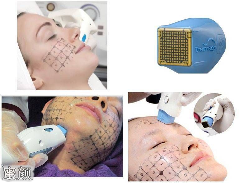https://img.miyanlife.com/mnt/Editor/2020-12-26/5fe75560eb5d2.jpg