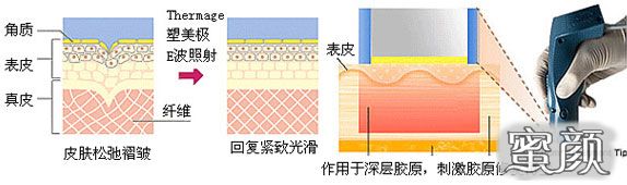 https://img.miyanlife.com/mnt/Editor/2020-12-27/5fe7f84487178.jpg
