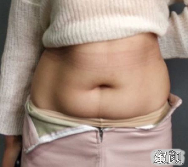 https://img.miyanlife.com/mnt/Editor/2020-12-27/5fe85778c7513.jpg