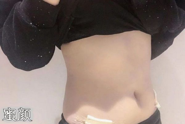 https://img.miyanlife.com/mnt/Editor/2020-12-27/5fe857790cf73.jpg