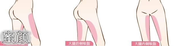 https://img.miyanlife.com/mnt/Editor/2020-12-27/5fe85779aa9d2.jpg