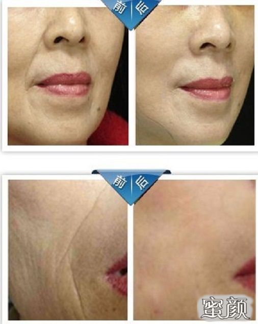https://img.miyanlife.com/mnt/Editor/2020-12-27/5fe85a8e817d7.jpg