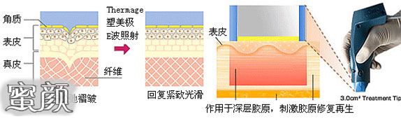https://img.miyanlife.com/mnt/Editor/2020-12-27/5fe8aa3fbe516.jpg