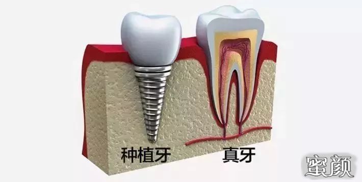 案例图片