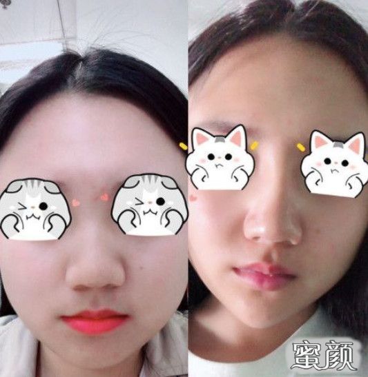 https://img.miyanlife.com/mnt/Editor/2020-12-29/5feb235a91373.jpg