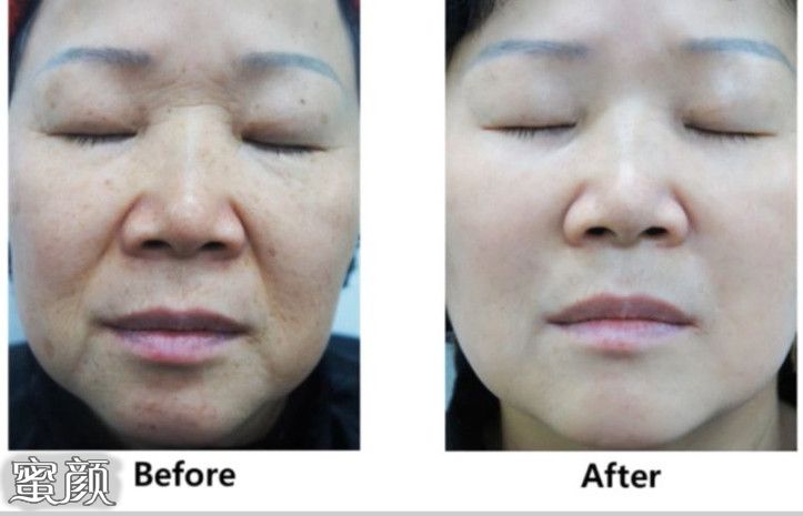 https://img.miyanlife.com/mnt/Editor/2020-12-29/5feb292714b71.jpg
