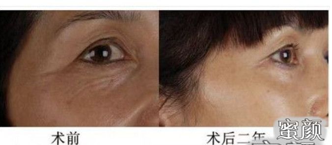 https://img.miyanlife.com/mnt/Editor/2020-12-29/5feb2994996b9.jpg