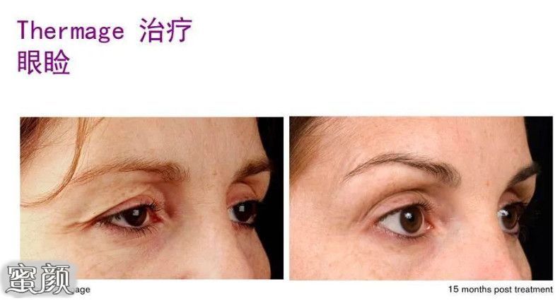 https://img.miyanlife.com/mnt/Editor/2020-12-29/5feb29b5510bd.jpg