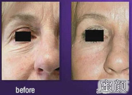 https://img.miyanlife.com/mnt/Editor/2020-12-29/5feb29c8dc23d.jpg