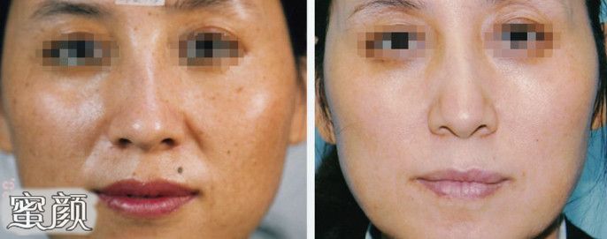 https://img.miyanlife.com/mnt/Editor/2020-12-29/5feb2a133a324.jpg