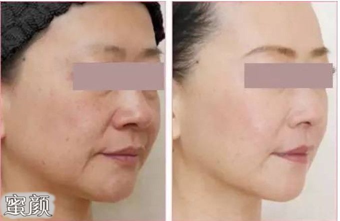 https://img.miyanlife.com/mnt/Editor/2020-12-30/5fec1c959fb7f.jpg