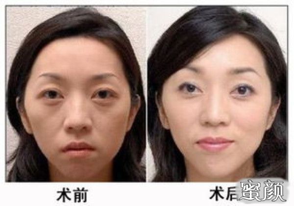 https://img.miyanlife.com/mnt/Editor/2020-12-30/5fec1d24411bf.jpg