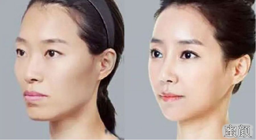 https://img.miyanlife.com/mnt/Editor/2020-12-30/5fec1e80b1584.jpg