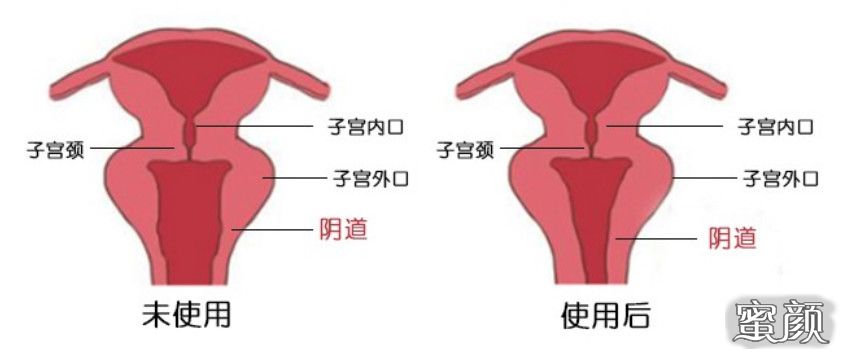 案例图片