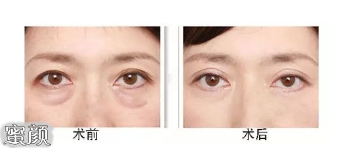 https://img.miyanlife.com/mnt/Editor/2021-01-02/5ff024db925c4.jpg