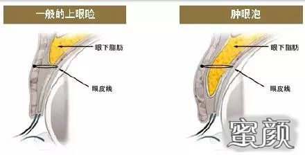 案例图片