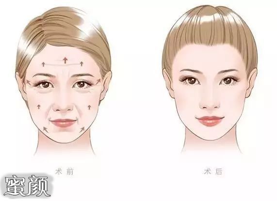 https://img.miyanlife.com/mnt/Editor/2021-01-03/5ff129fb06a2c.jpg