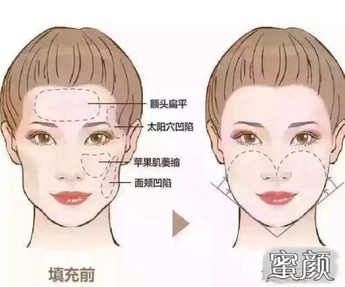 https://img.miyanlife.com/mnt/Editor/2021-01-03/5ff13be0836e4.jpg