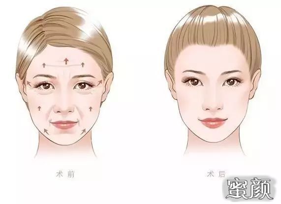 https://img.miyanlife.com/mnt/Editor/2021-01-03/5ff146908af30.jpg