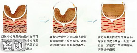 https://img.miyanlife.com/mnt/Editor/2021-01-03/5ff1a3d705460.jpg