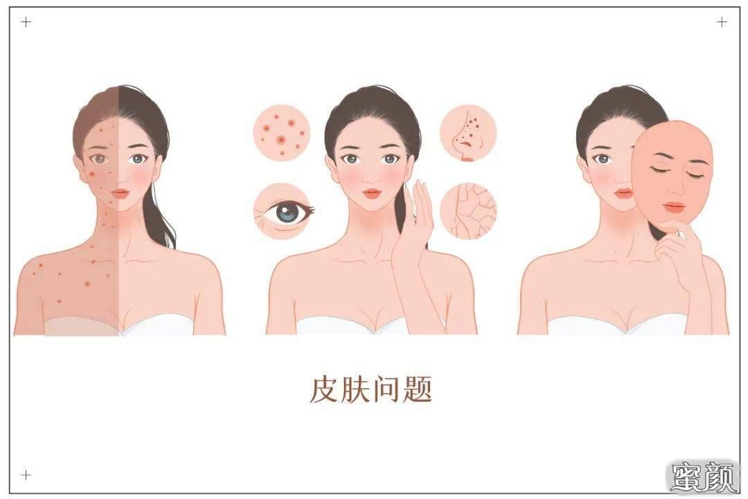 https://img.miyanlife.com/mnt/Editor/2021-01-05/5ff3bae861cd3.jpg