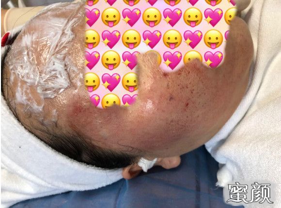 https://img.miyanlife.com/mnt/Editor/2021-01-05/5ff3bc42280bb.jpg