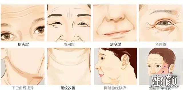 https://img.miyanlife.com/mnt/Editor/2021-01-05/5ff3d41896555.jpg