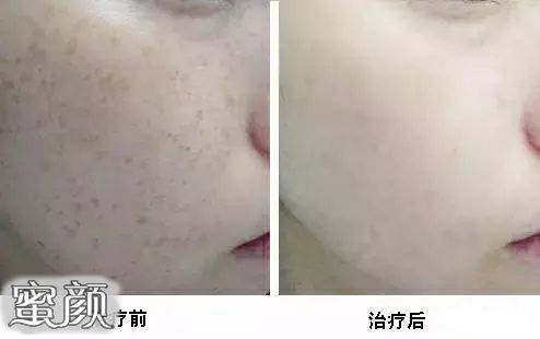 https://img.miyanlife.com/mnt/Editor/2021-01-05/5ff3d44d5d275.jpg