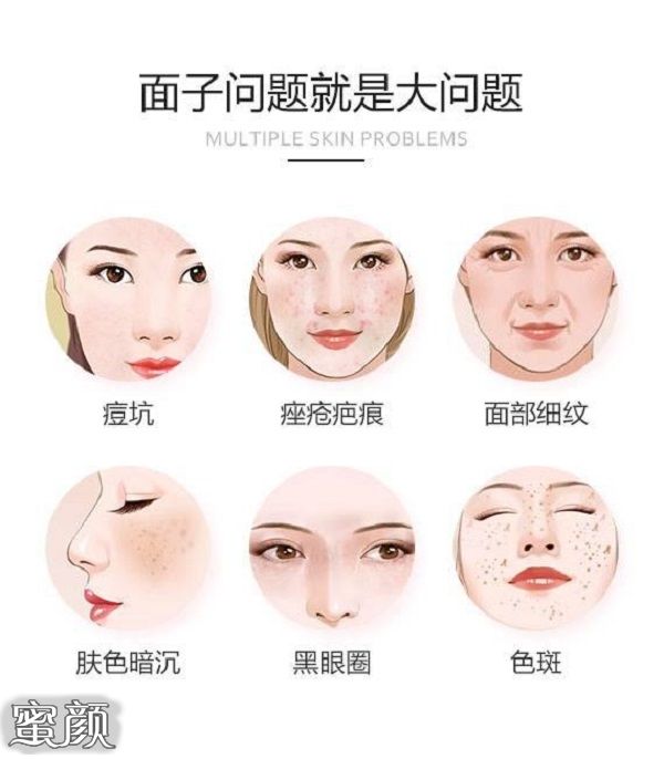 https://img.miyanlife.com/mnt/Editor/2021-01-06/5ff493857b371.jpg