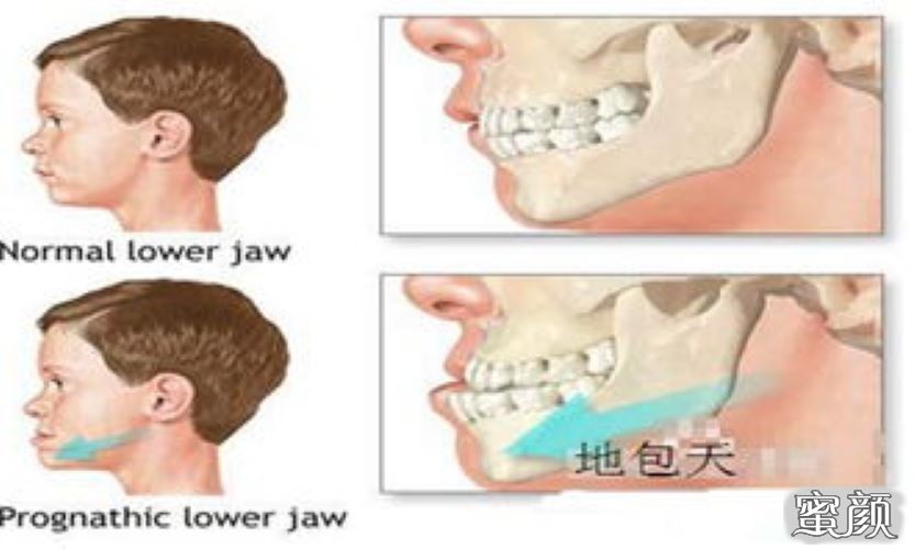 案例图片