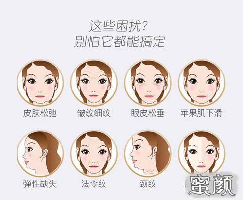 https://img.miyanlife.com/mnt/Editor/2021-01-10/5ffae940b2e4d.jpg
