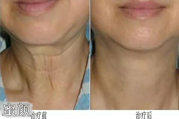 https://img.miyanlife.com/mnt/Editor/2021-01-12/5ffd5597aee25.jpg