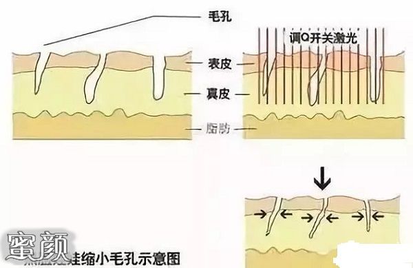 案例图片