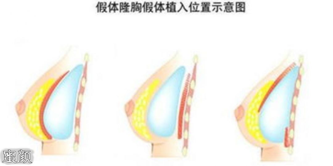 https://img.miyanlife.com/mnt/Editor/2021-01-21/600949532c9e2.jpg