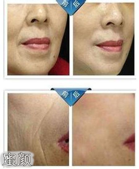 https://img.miyanlife.com/mnt/Editor/2021-01-21/60097509dbaf2.jpg