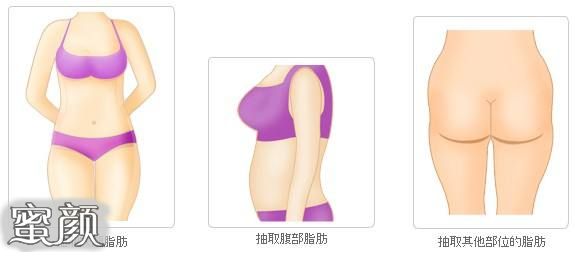 https://img.miyanlife.com/mnt/Editor/2021-01-22/600a173963e8a.jpg