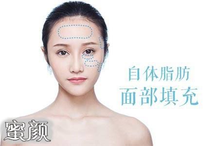 https://img.miyanlife.com/mnt/Editor/2021-01-22/600a17532667e.jpg