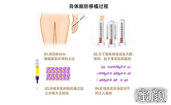 https://img.miyanlife.com/mnt/Editor/2021-01-22/600a1774d50fe.jpg