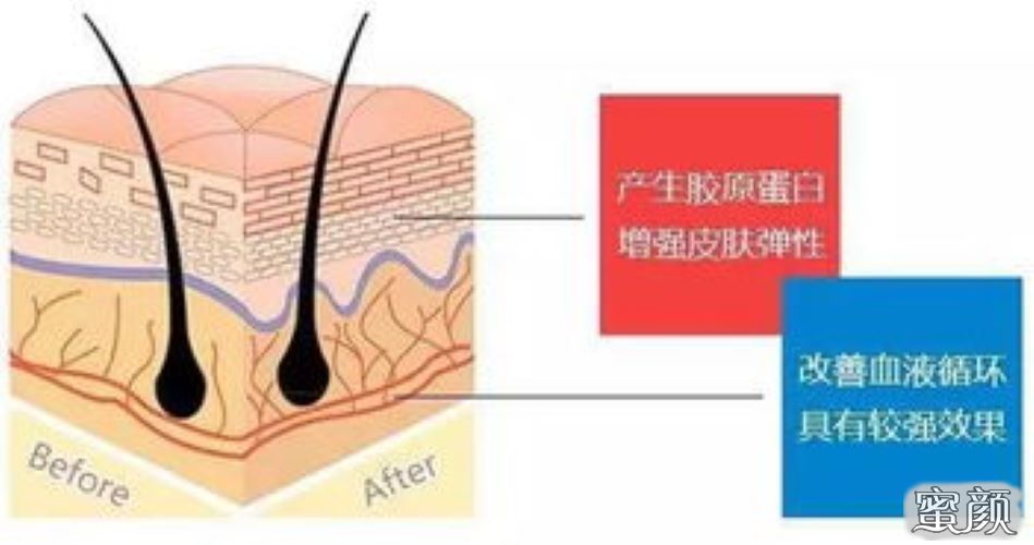 案例图片