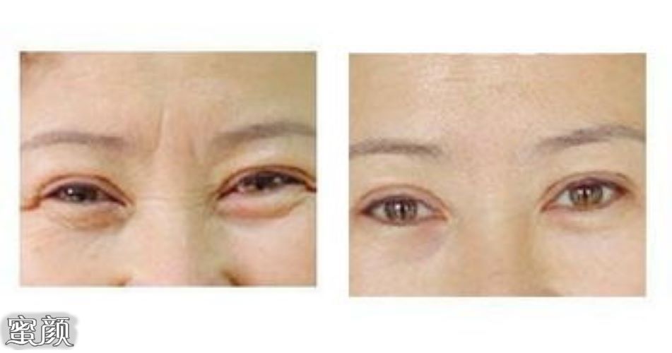 https://img.miyanlife.com/mnt/Editor/2021-01-27/60111907dff49.jpg